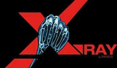 Rasmus - X-ray