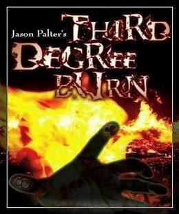 Jason Palter - Third Degree Burn