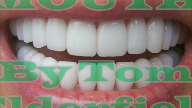 Tom Elderfield - MOUTH
