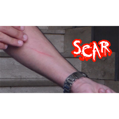 Dan Alex - SCAR