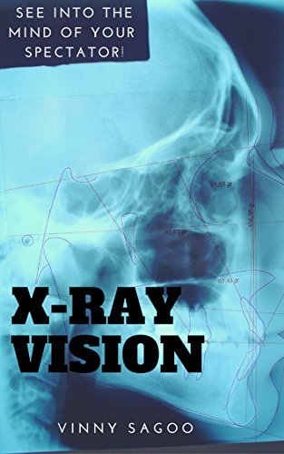 Vinny Sagoo - XRay Vision