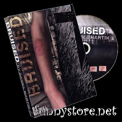 (image for) Daniel Martin - Bruised